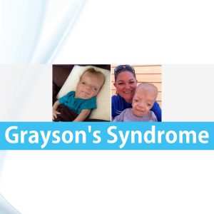 Graysons Syndrome Grayson Wilbrandt Corneal Dystrophy Rish Academy