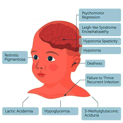 mitochondrial inheritance examples Clinical features of Leigh Syndrome