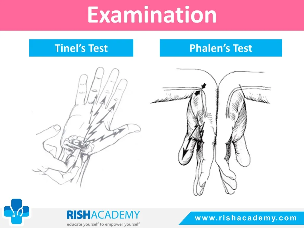 Carpal Tunnel Syndrome free medical notes rish academy (8)