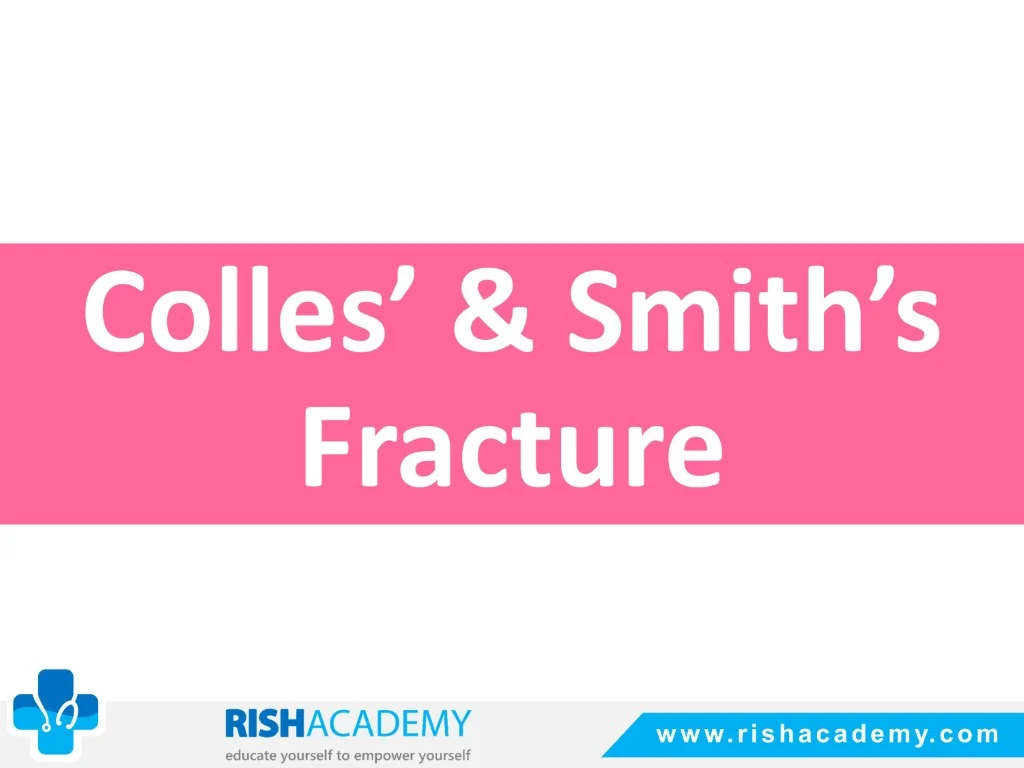 Colles’ & Smith’s Fracture free medical notes rish academy (1)