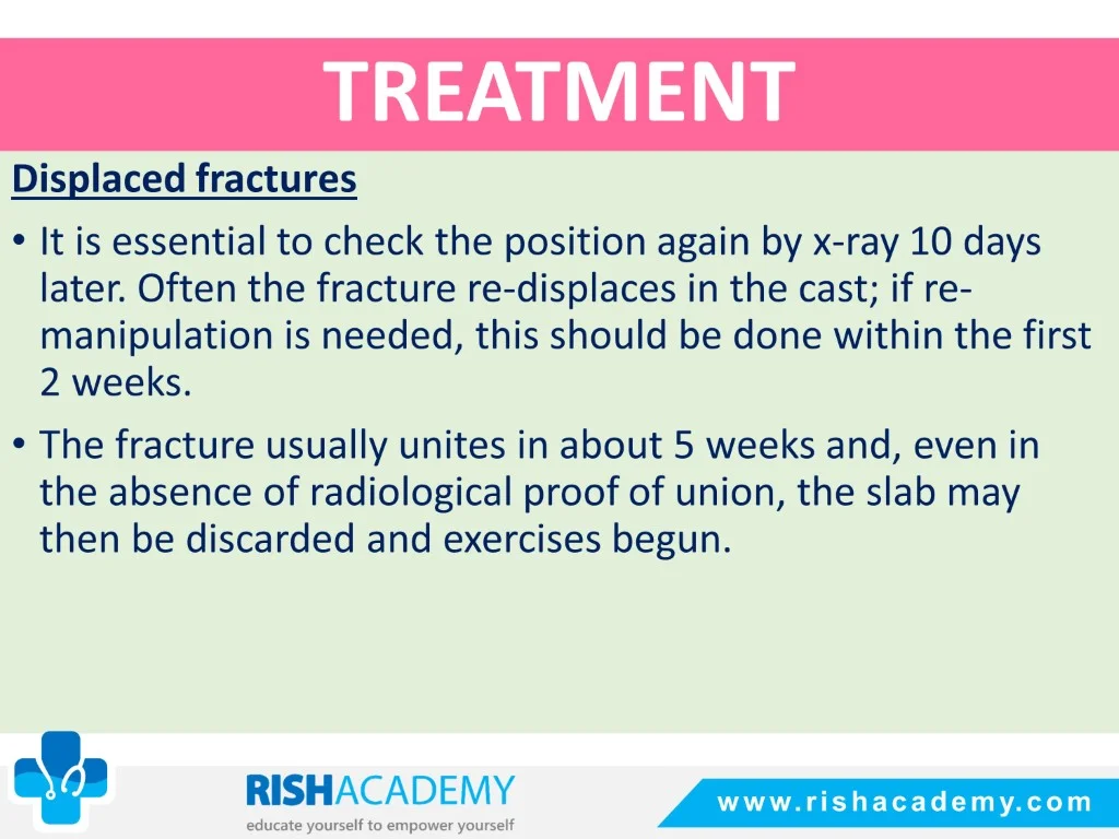 Colles’ & Smith’s Fracture free medical notes rish academy (10)