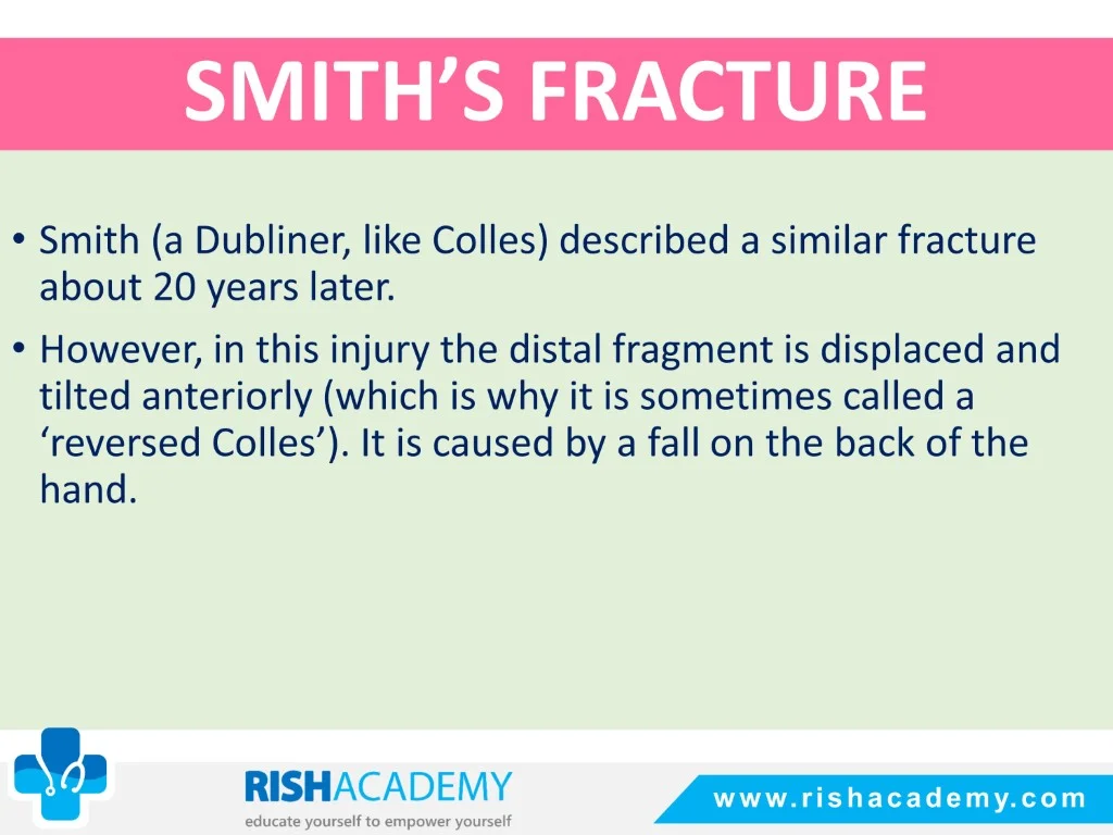 Colles’ & Smith’s Fracture free medical notes rish academy (15)