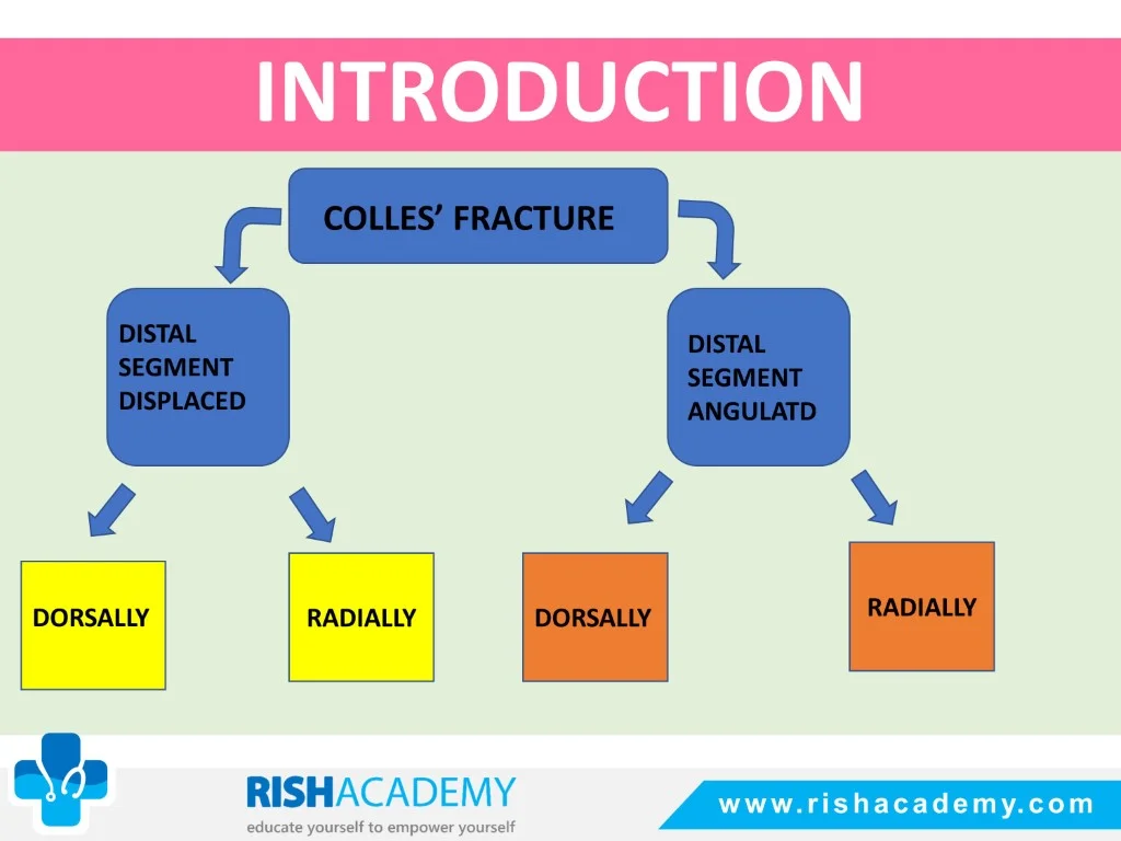 Colles’ & Smith’s Fracture free medical notes rish academy (4)