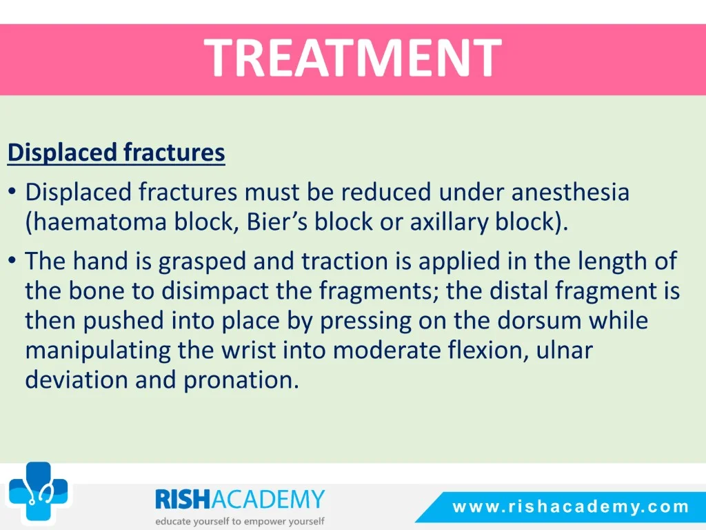 Colles’ & Smith’s Fracture free medical notes rish academy (8)