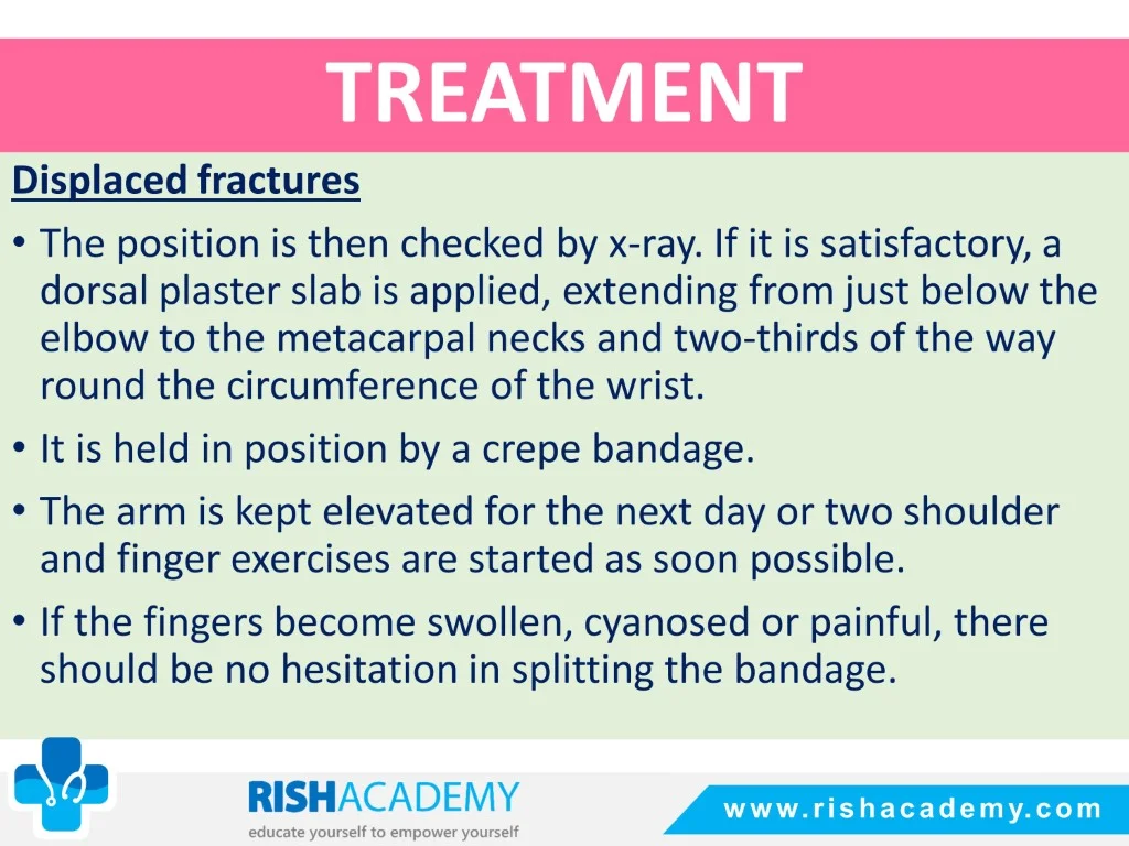 Colles’ & Smith’s Fracture free medical notes rish academy (9)