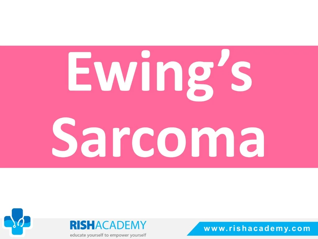 Ewing’s Sarcoma free medical notes rish academy (1)