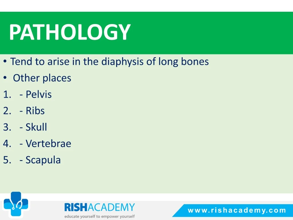 Ewing’s Sarcoma free medical notes rish academy (4)