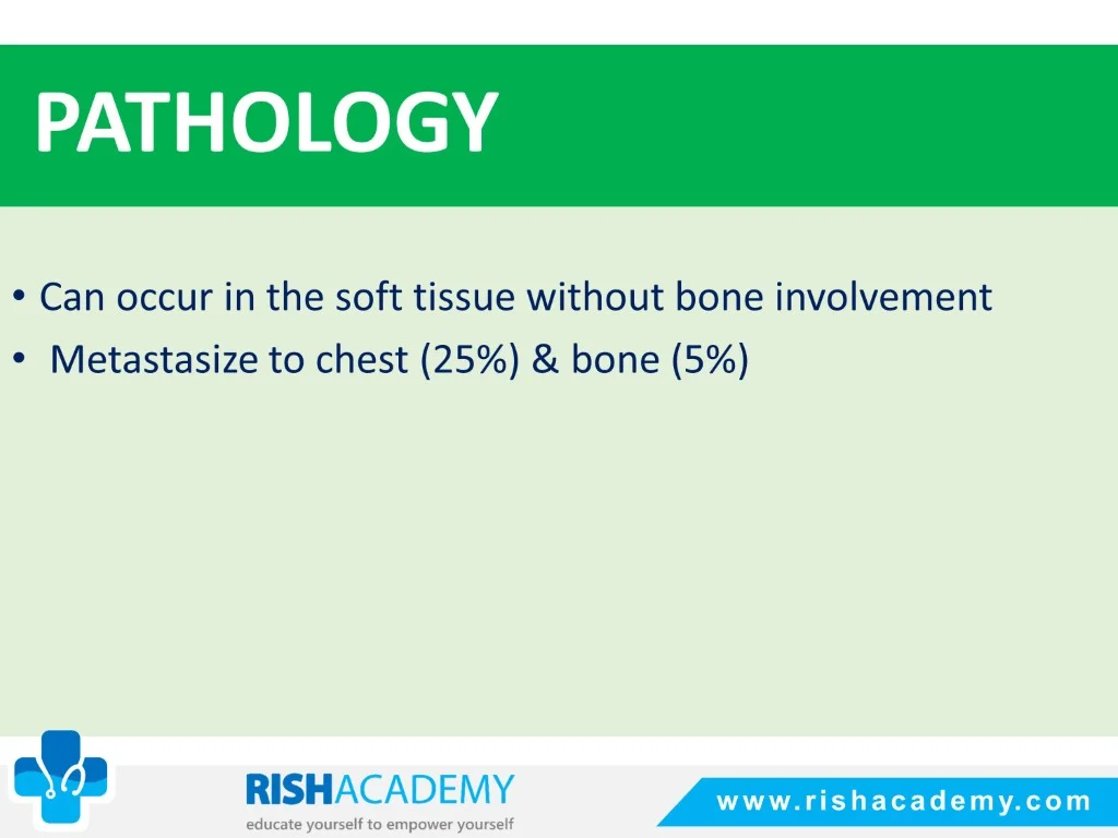 Ewing’s Sarcoma free medical notes rish academy (5)