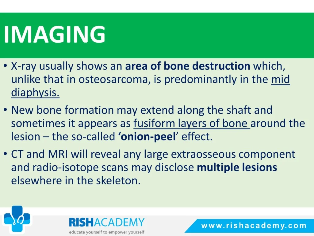 Ewing’s Sarcoma free medical notes rish academy (7)