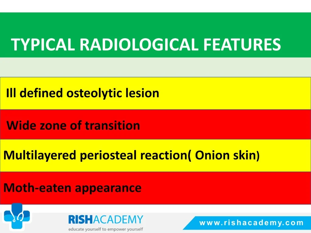 Ewing’s Sarcoma free medical notes rish academy (8)