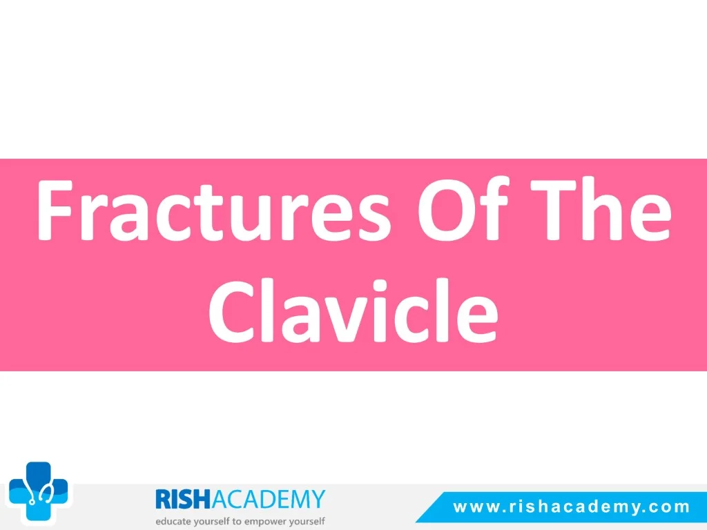 Fractures Of The Clavicle free medical notes rish academy (1)