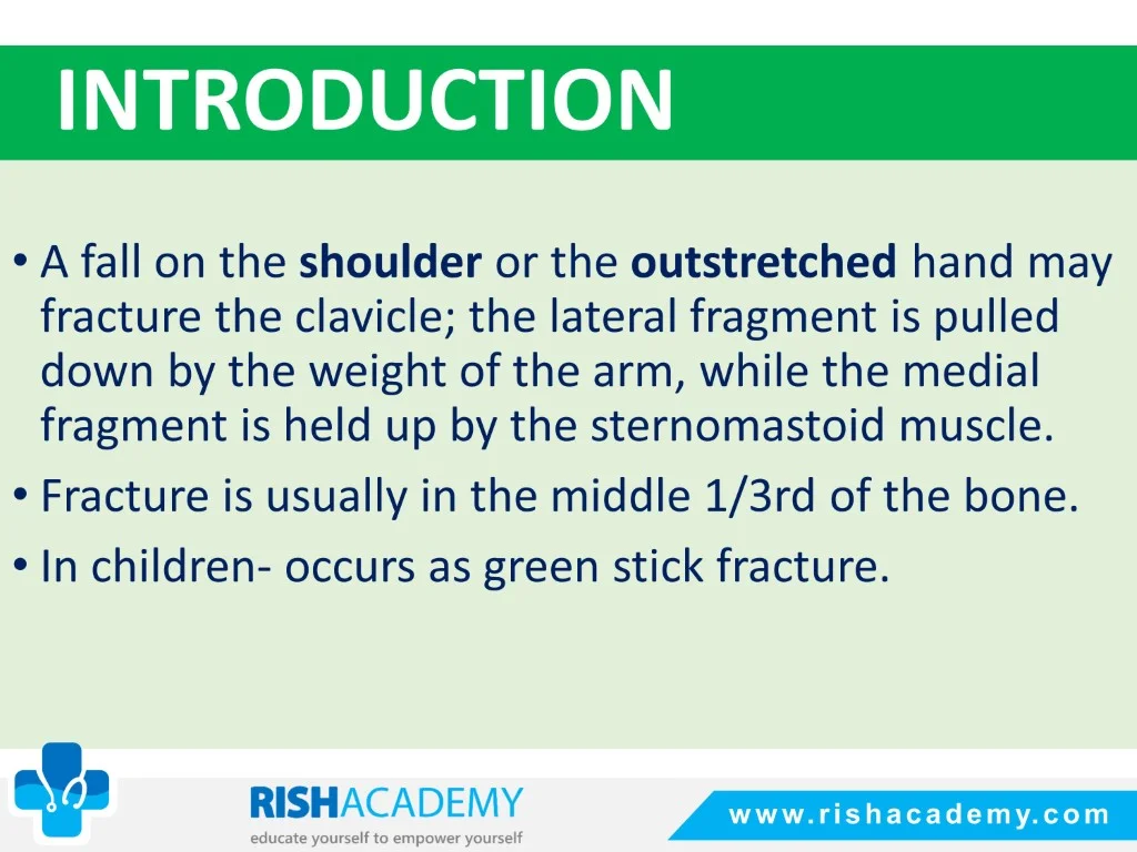 Fractures Of The Clavicle free medical notes rish academy (2)