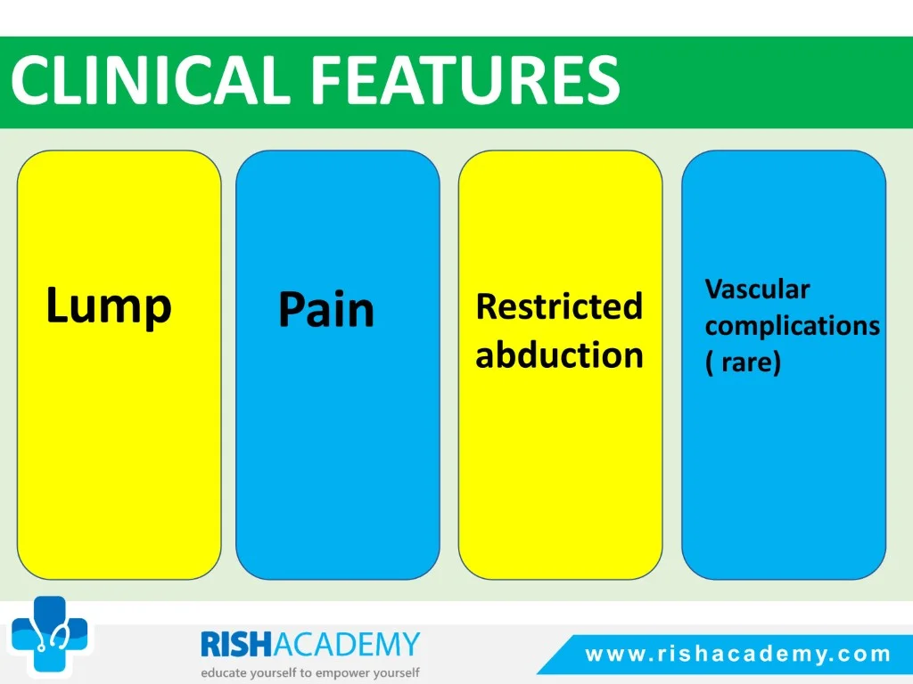 Fractures Of The Clavicle free medical notes rish academy (4)