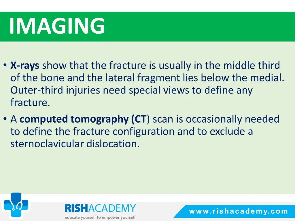 Fractures Of The Clavicle free medical notes rish academy (5)