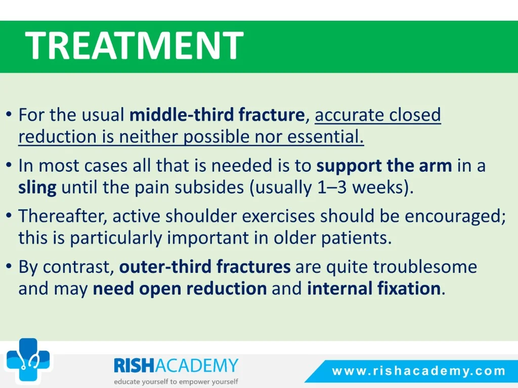 Fractures Of The Clavicle free medical notes rish academy (6)