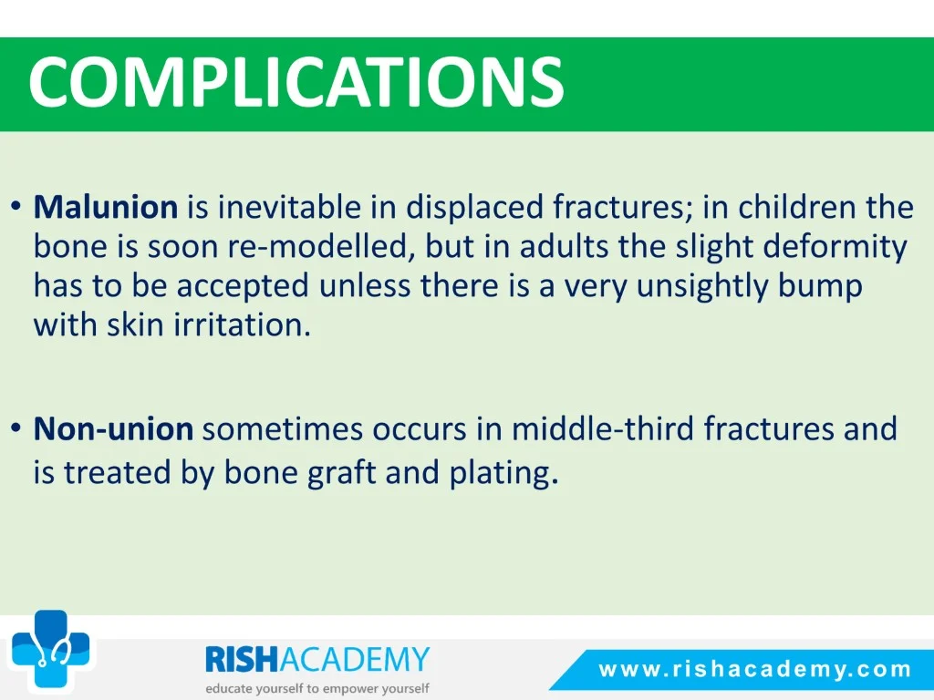 Fractures Of The Clavicle free medical notes rish academy (8)