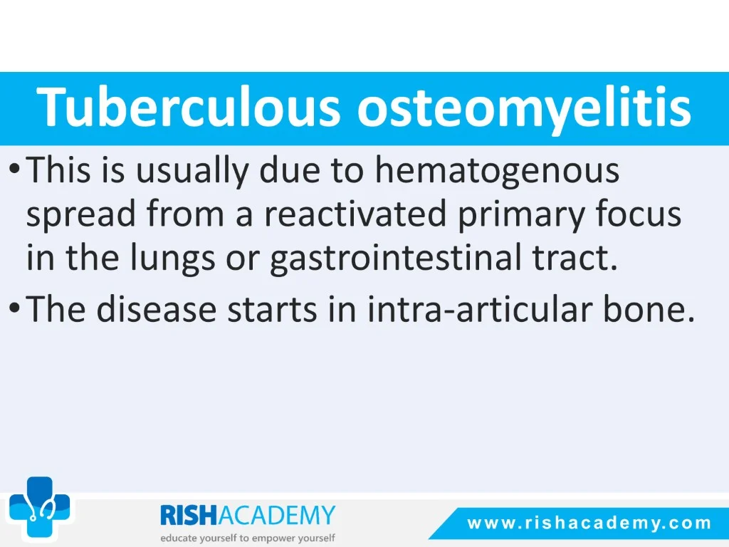 Osteomyelitis free medical notes rish academy (17)