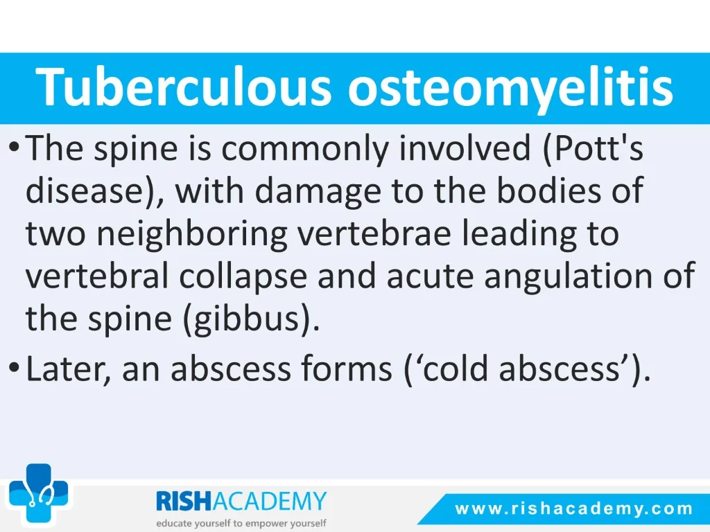 Osteomyelitis free medical notes rish academy (18)