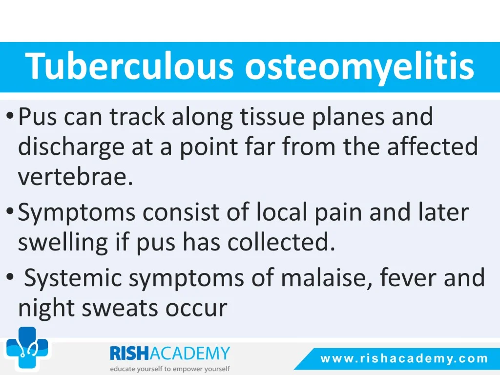 Osteomyelitis free medical notes rish academy (19)