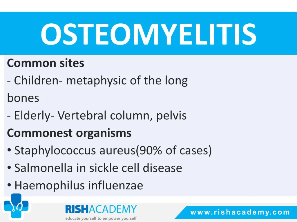 Osteomyelitis free medical notes rish academy (5)