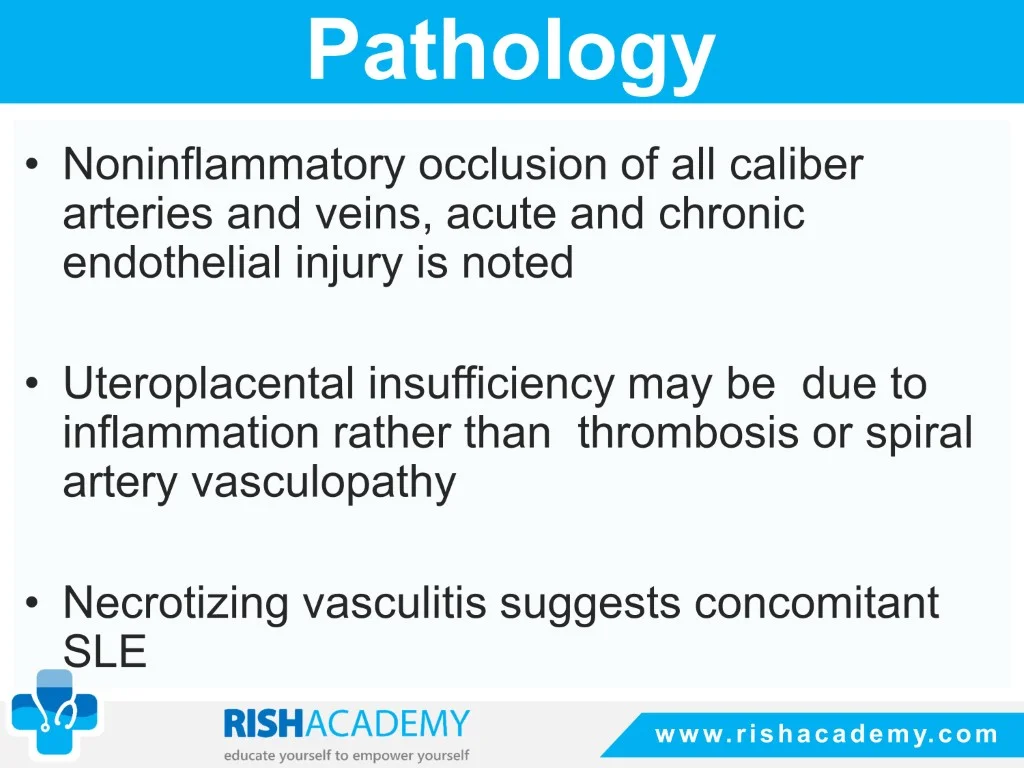 Slide17