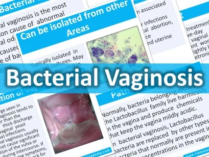 Bacterial Vaginosis - Rish Academy