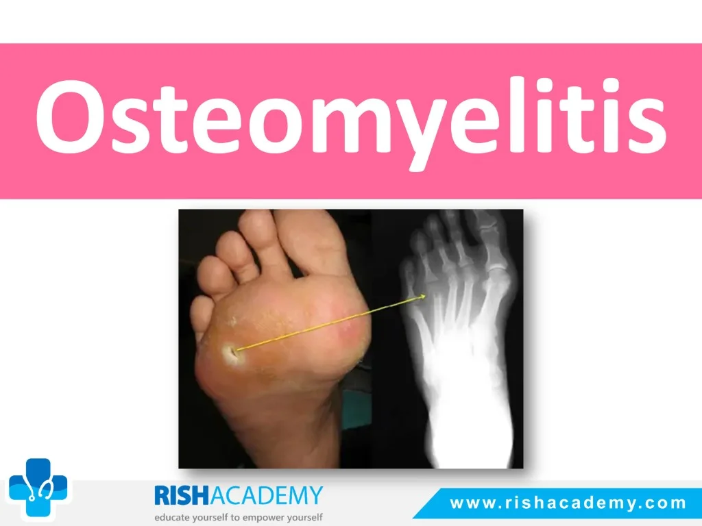 rish academy orthopedics sample images (1)